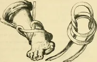 An illustration from Collection de chirurgiens grecs avec dessins attribués au Primatice. Reproduction réduite des 200 dessins du Manuscrit latin 6866 de la Bibliothèque nationale (1908)