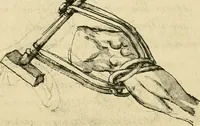 Picture 149 of 195 from Collection de chirurgiens grecs avec dessins attribués au Primatice. Reproduction réduite des 200 dessins du Manuscrit latin 6866 de la Bibliothèque nationale (1908), leaf 156
