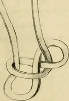 Picture 154 of 195 from Collection de chirurgiens grecs avec dessins attribués au Primatice. Reproduction réduite des 200 dessins du Manuscrit latin 6866 de la Bibliothèque nationale (1908), leaf 160