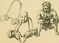 Picture 158 of 195 from Collection de chirurgiens grecs avec dessins attribués au Primatice. Reproduction réduite des 200 dessins du Manuscrit latin 6866 de la Bibliothèque nationale (1908), leaf 162