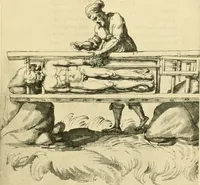 An illustration from Collection de chirurgiens grecs avec dessins attribués au Primatice. Reproduction réduite des 200 dessins du Manuscrit latin 6866 de la Bibliothèque nationale (1908)