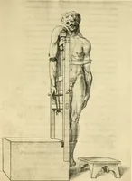 Picture 182 of 195 from Collection de chirurgiens grecs avec dessins attribués au Primatice. Reproduction réduite des 200 dessins du Manuscrit latin 6866 de la Bibliothèque nationale (1908), leaf 208
