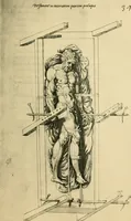 An illustration from Collection de chirurgiens grecs avec dessins attribués au Primatice. Reproduction réduite des 200 dessins du Manuscrit latin 6866 de la Bibliothèque nationale (1908)