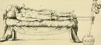 An illustration from Collection de chirurgiens grecs avec dessins attribués au Primatice. Reproduction réduite des 200 dessins du Manuscrit latin 6866 de la Bibliothèque nationale (1908)