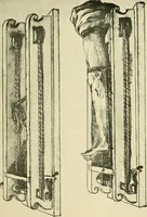 Picture 8 of 195 from Collection de chirurgiens grecs avec dessins attribués au Primatice. Reproduction réduite des 200 dessins du Manuscrit latin 6866 de la Bibliothèque nationale (1908), leaf 38