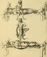 Picture 22 of 195 from Collection de chirurgiens grecs avec dessins attribués au Primatice. Reproduction réduite des 200 dessins du Manuscrit latin 6866 de la Bibliothèque nationale (1908), leaf 68