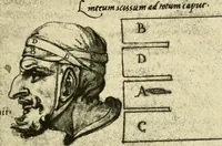 An illustration from Collection de chirurgiens grecs avec dessins attribués au Primatice. Reproduction réduite des 200 dessins du Manuscrit latin 6866 de la Bibliothèque nationale (1908)
