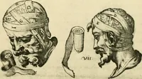 Picture 30 of 195 from Collection de chirurgiens grecs avec dessins attribués au Primatice. Reproduction réduite des 200 dessins du Manuscrit latin 6866 de la Bibliothèque nationale (1908), leaf 76