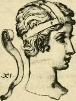 Picture 34 of 195 from Collection de chirurgiens grecs avec dessins attribués au Primatice. Reproduction réduite des 200 dessins du Manuscrit latin 6866 de la Bibliothèque nationale (1908), leaf 78