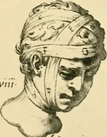 Picture 41 of 195 from Collection de chirurgiens grecs avec dessins attribués au Primatice. Reproduction réduite des 200 dessins du Manuscrit latin 6866 de la Bibliothèque nationale (1908), leaf 82