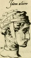 Picture 43 of 195 from Collection de chirurgiens grecs avec dessins attribués au Primatice. Reproduction réduite des 200 dessins du Manuscrit latin 6866 de la Bibliothèque nationale (1908), leaf 84