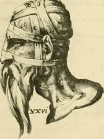 Picture 49 of 195 from Collection de chirurgiens grecs avec dessins attribués au Primatice. Reproduction réduite des 200 dessins du Manuscrit latin 6866 de la Bibliothèque nationale (1908), leaf 86