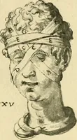 Picture 59 of 195 from Collection de chirurgiens grecs avec dessins attribués au Primatice. Reproduction réduite des 200 dessins du Manuscrit latin 6866 de la Bibliothèque nationale (1908), leaf 92