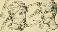 An illustration from Collection de chirurgiens grecs avec dessins attribués au Primatice. Reproduction réduite des 200 dessins du Manuscrit latin 6866 de la Bibliothèque nationale (1908)