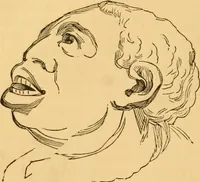 An illustration from Comparative physiognomy; or, Resemblances between men and animals (1852)