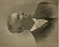 An illustration from A concise and rational course in hypnotism (1900)