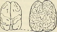 An illustration from The connection between physiology and intellectual philosophy (1846)