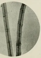 An illustration from The conservation of textiles (1921)