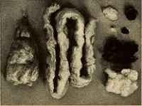 An illustration from Cotton (1900)