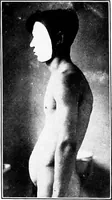 An illustration from ... Studies in vocational diseases (1915)