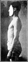 An illustration from ... Studies in vocational diseases (1915)