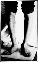 An illustration from ... Studies in vocational diseases (1915)