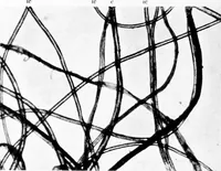 An illustration from Wool substitutes (1922)