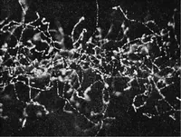 An illustration from X rays (1918)