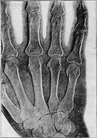 An illustration from X rays (1918)