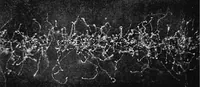 An illustration from X rays (1918)