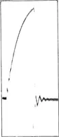An illustration from X rays (1918)