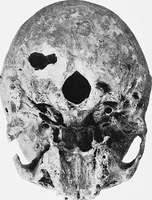 Picture 26 of 39 from The mortal remains of Emanuel Swedenborg; an account of the historical and anatomical investigations executed by a committee, appointed on May 27th, 1908 (1910), leaf 114