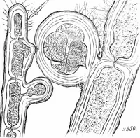 An illustration from How to work with the microscope (1865)