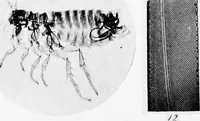 An illustration from How to work with the microscope (1865)