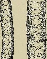 An illustration from Cyclopedia of textile work : a general reference library on cotton, woolen and worsted yarn manufacture, weaving, designing, chemistry and dyeing, finishing, knitting, and allied subjects (1911)
