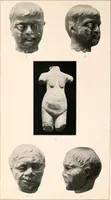 An illustration from Darstellungen normaler und krankhaft veränderter Körperteile an antiken Weihgaben (1912)