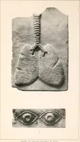 Picture 2 of 4 from Darstellungen normaler und krankhaft veränderter Körperteile an antiken Weihgaben (1912), leaf 34