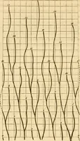 An illustration from Das Mikroskop, Theorie und Anwendung desselben (1867)