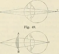 An illustration from Das mikroskop : Theorie, gebrauch, geschichte und gegenwärtiger zustand desselben (1866)