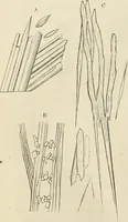 An illustration from Das mikroskop : Theorie, gebrauch, geschichte und gegenwärtiger zustand desselben (1866)