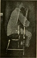 An illustration from Das Röntgen-Verfahren mit besonderer Berücksichtigung der militärischen Verhältnisse (1903)