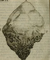 An illustration from De drie boecken der medicijnsche aenmerkingen : in 't Latijn beschreven (1650)
