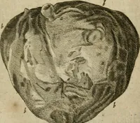 An illustration from De drie boecken der medicijnsche aenmerkingen : in 't Latijn beschreven (1650)