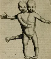 An illustration from De drie boecken der medicijnsche aenmerkingen : in 't Latijn beschreven (1650)