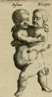An illustration from De drie boecken der medicijnsche aenmerkingen : in 't Latijn beschreven (1650)