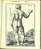 An illustration from De humani corporis fabrica libri decem : (1632)