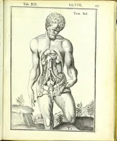 An illustration from De humani corporis fabrica libri decem : (1632)