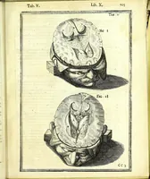An illustration from De humani corporis fabrica libri decem : (1632)