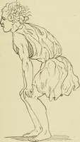 An illustration from De la physionomie et des mouvements d'expression suivie d'une notice sur sa vie et ses travaux et de la nomenclature de ses ouvrages (1865)