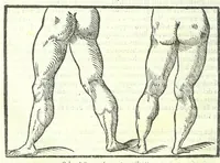 An illustration from Della fisonomia dell'huomo (1613)